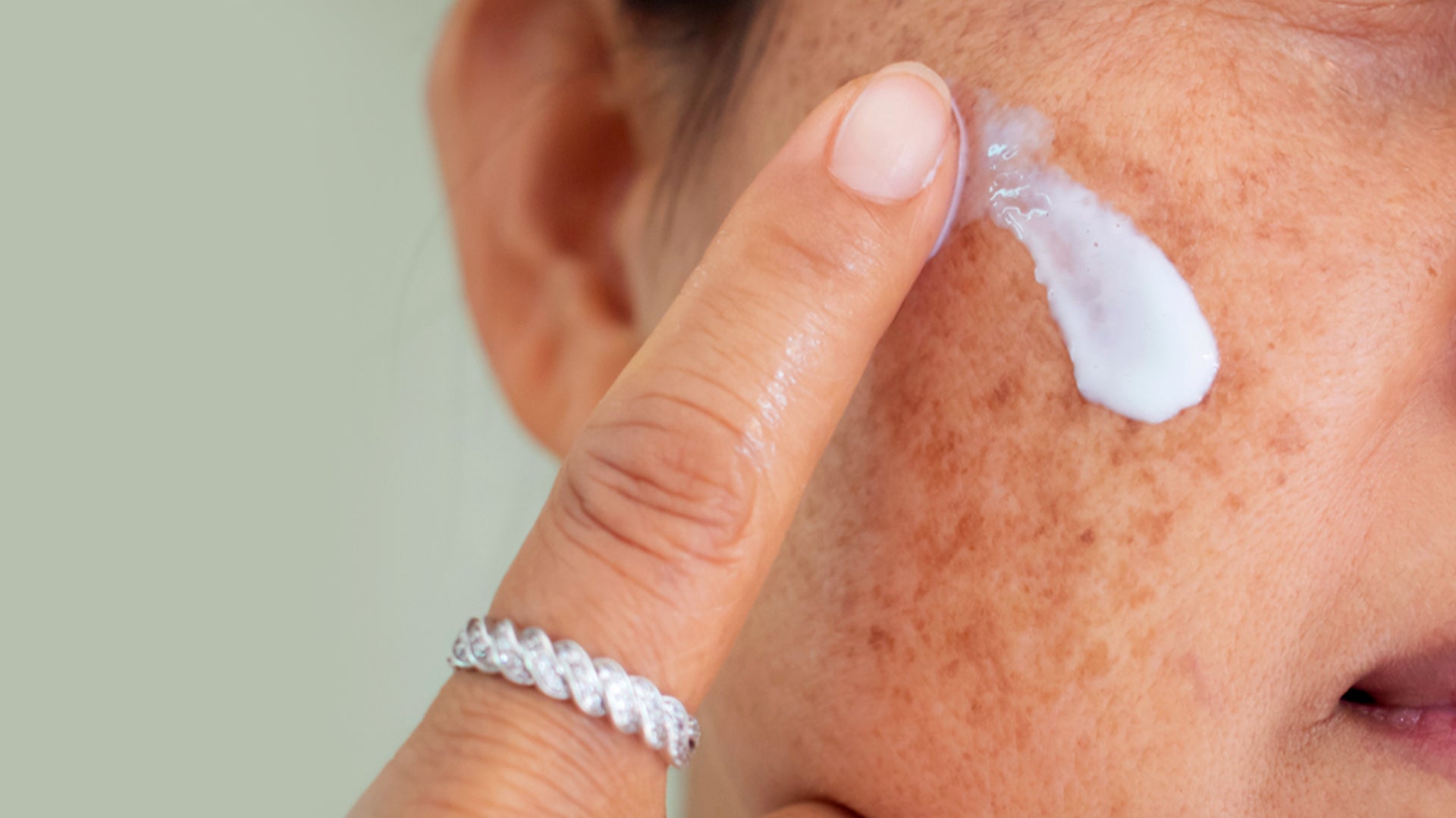 Acne And Pigmentation For Dry Skin