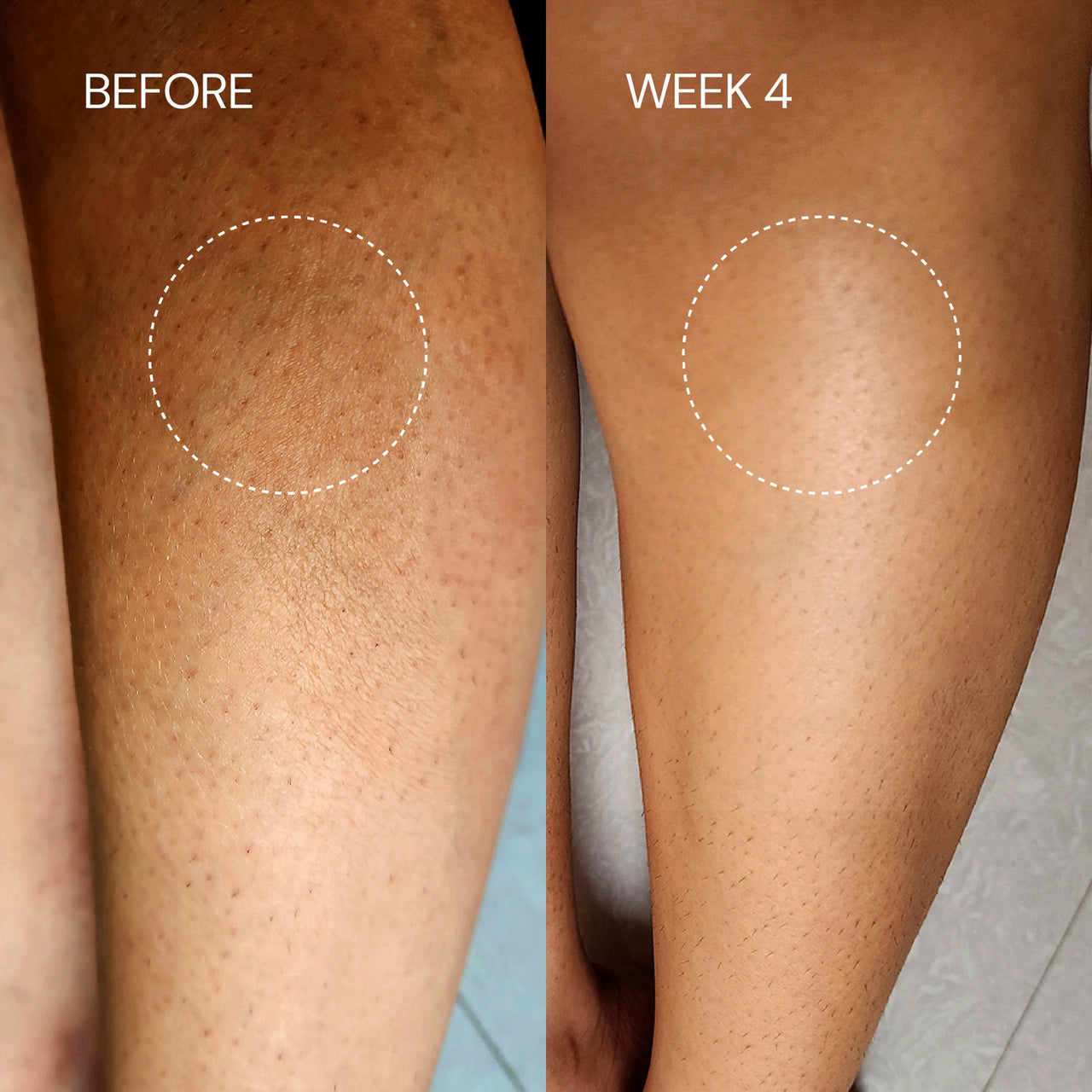Lactic Body Lotion