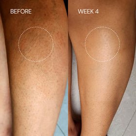 Lactic Body Lotion 100 ml