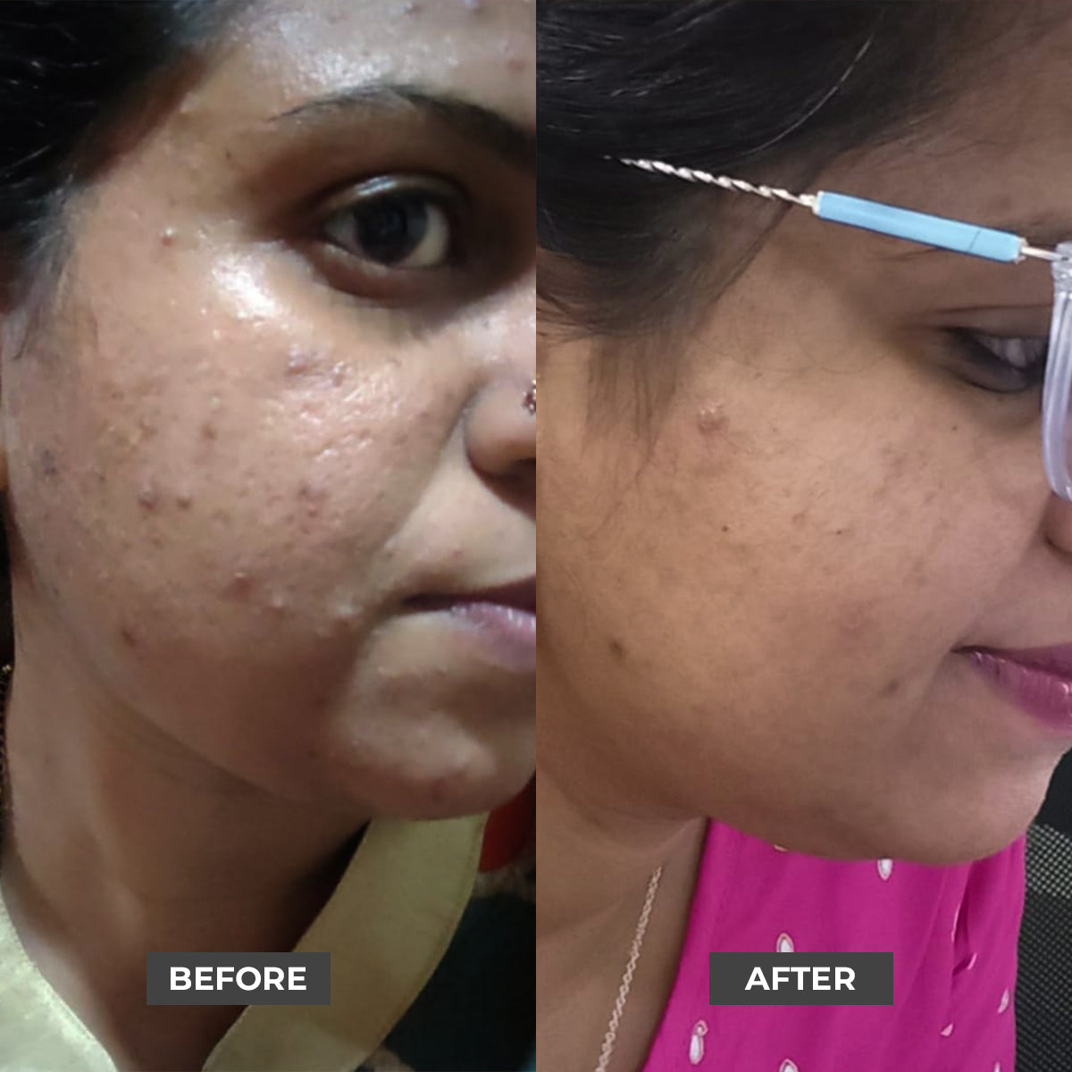 BHA Exfoliating Serum, Salicylic Acid Serum