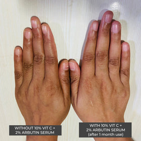 10% Vit C + 2% Arbutin Serum