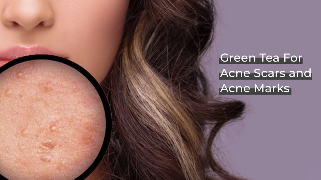 Green tea for acne scars and acne marks Facewash for Acne Prone Skin