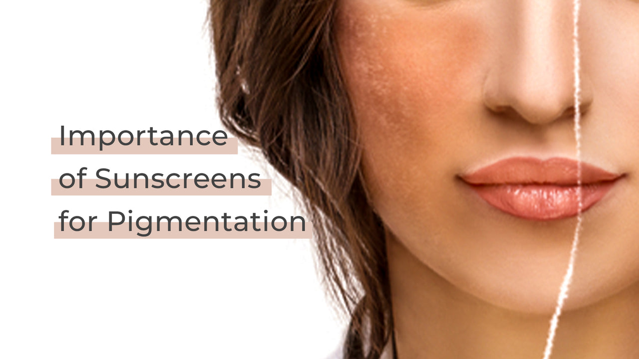 Sunscreens for Pigmentation Best Serum and Creams for Hyperpigmentation Suganda Skincare