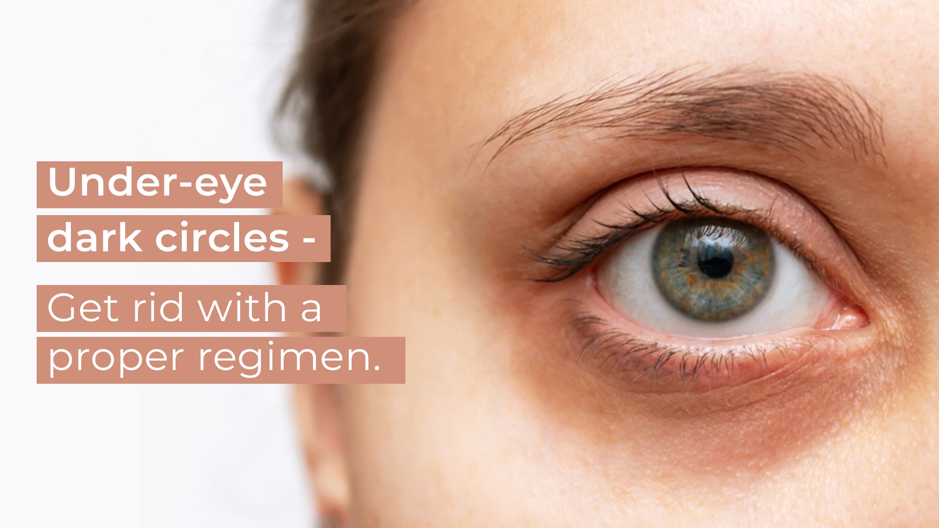 Under-eye dark circles - Get rid with a proper regimen