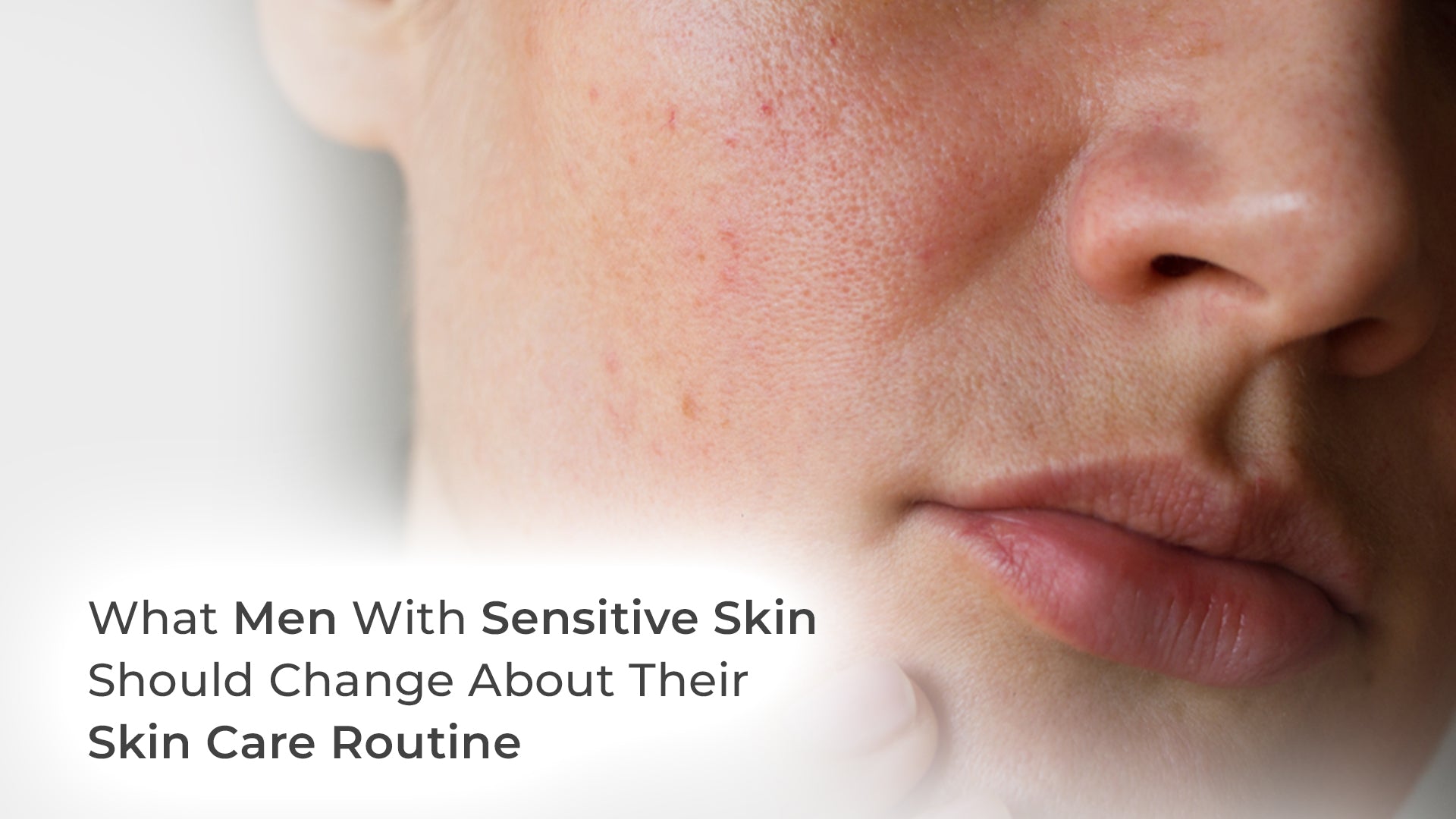 What Men with Sensitive Skin Should Change About Their Skin Care Routine
