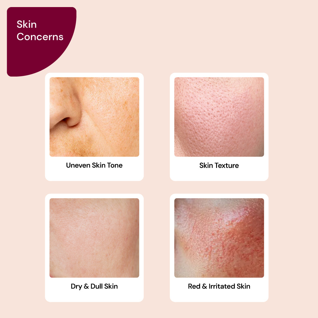 5% Lactic Acid Serum
