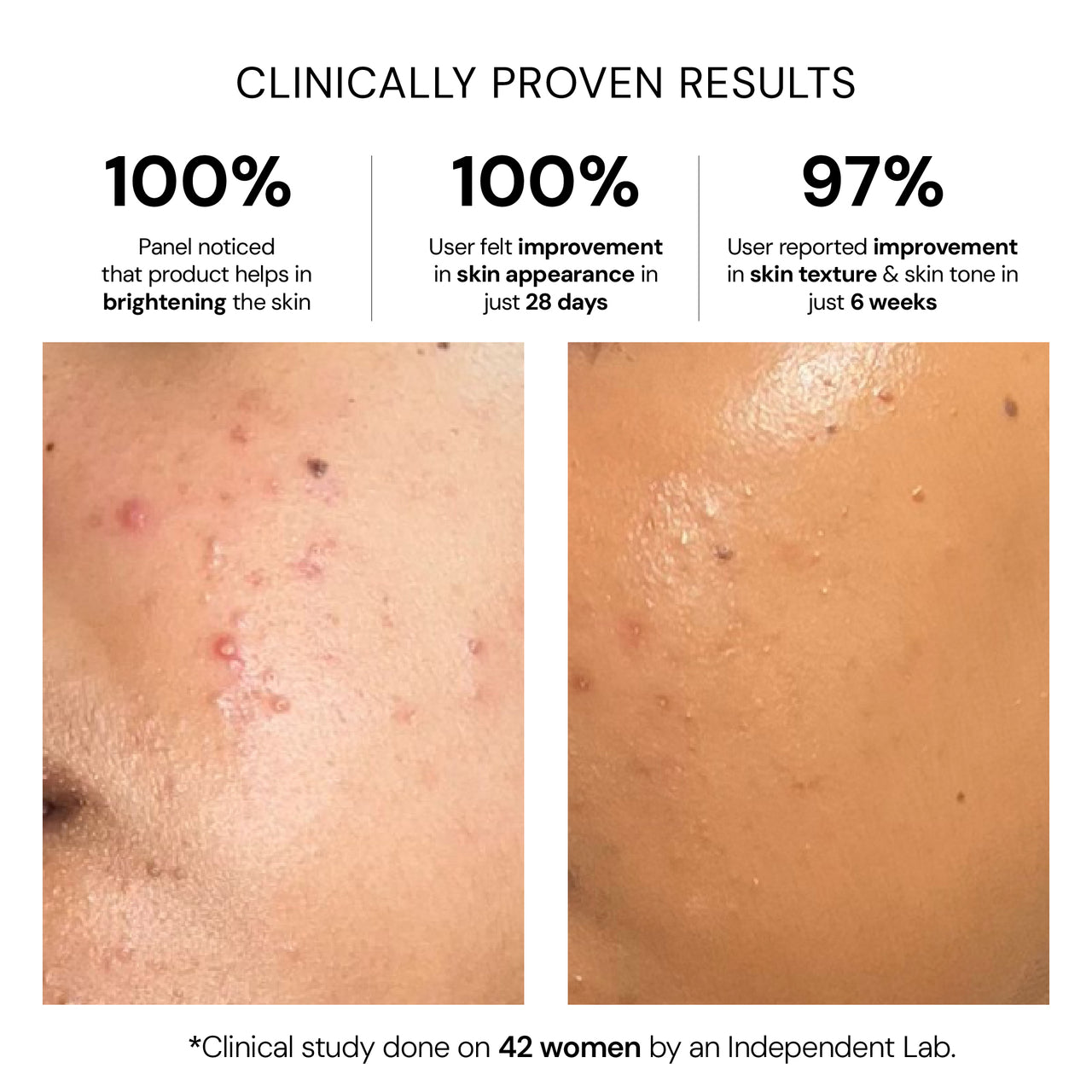 Advanced Pigmentation Serum