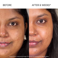 Thumbnail for Advanced Pigmentation Serum