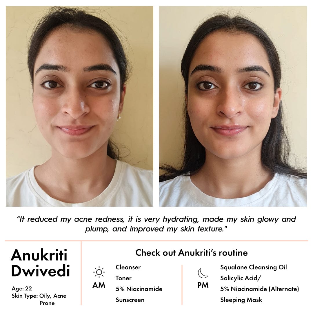 Vitamin B3 Serum Benefits: Bí Quyết Chăm Sóc Da Toàn Diện