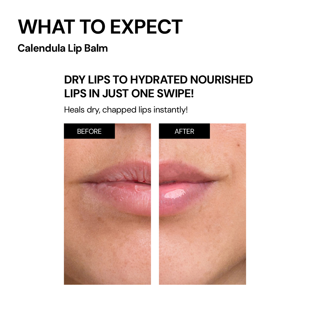 Winter Skincare Kit