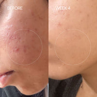 Thumbnail for Centella Green Tea Facewash