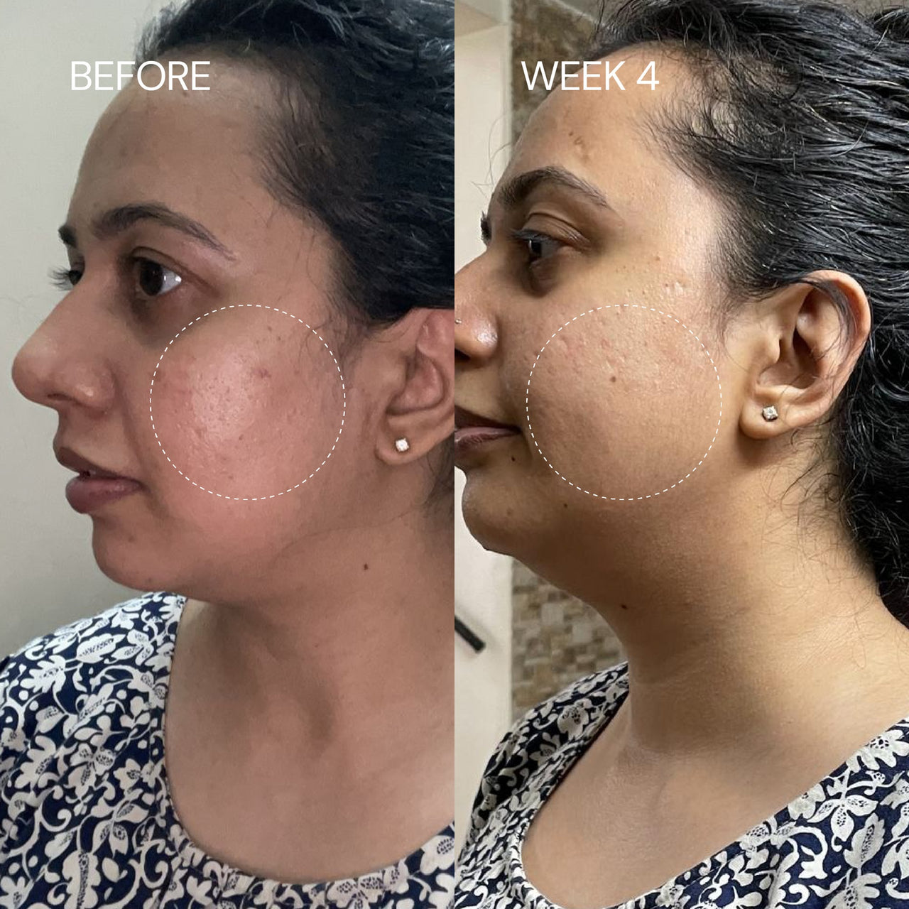 2% Granactive Retinoid
