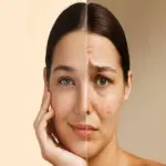 5% Best Ingredients For Hyperpigmentation: A Complete Guide to Brighter and More Even Skin