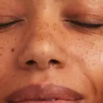 Best Foundation for Oily Acne Prone Skin: 5 Best Ingredients for Hyperpigmentation
