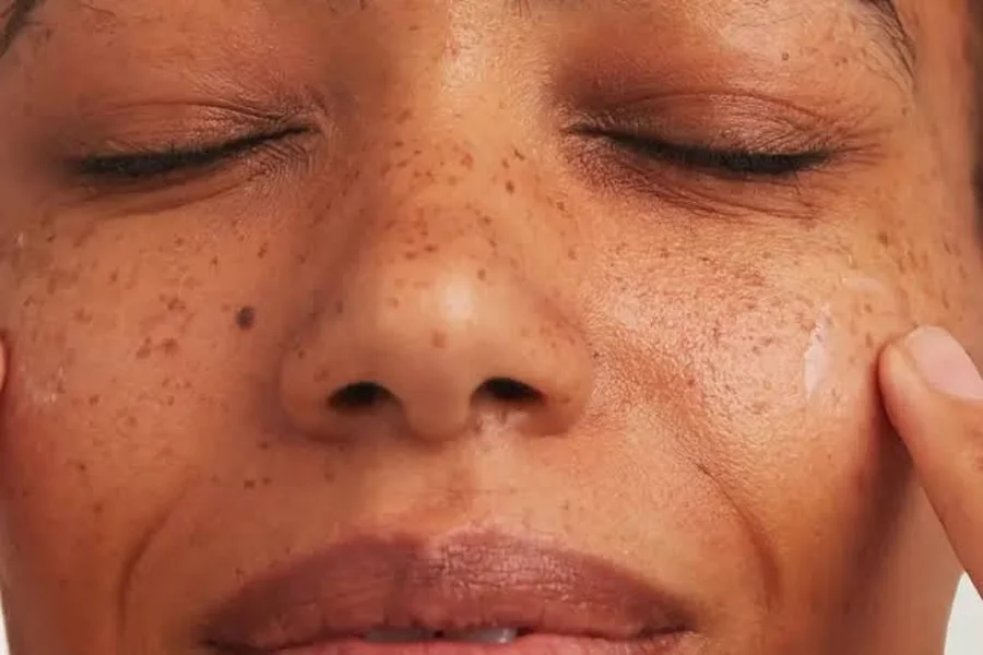 Best Foundation for Oily Acne Prone Skin: 5 Best Ingredients for Hyperpigmentation