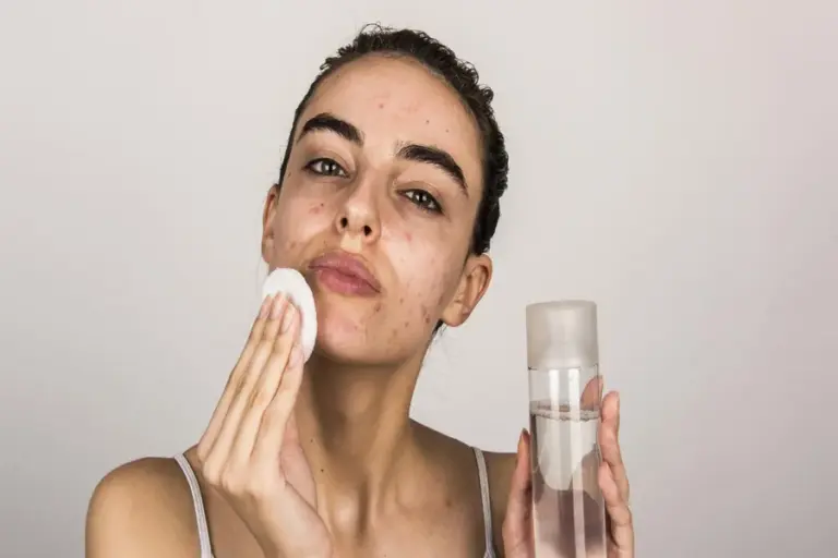 Acne Prone Skin How To Prevent Damage During Your Skincare Routine