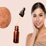 Arbutin Tranexamic Acid Face Serum Benefits Uses and Complete Skincare Guide