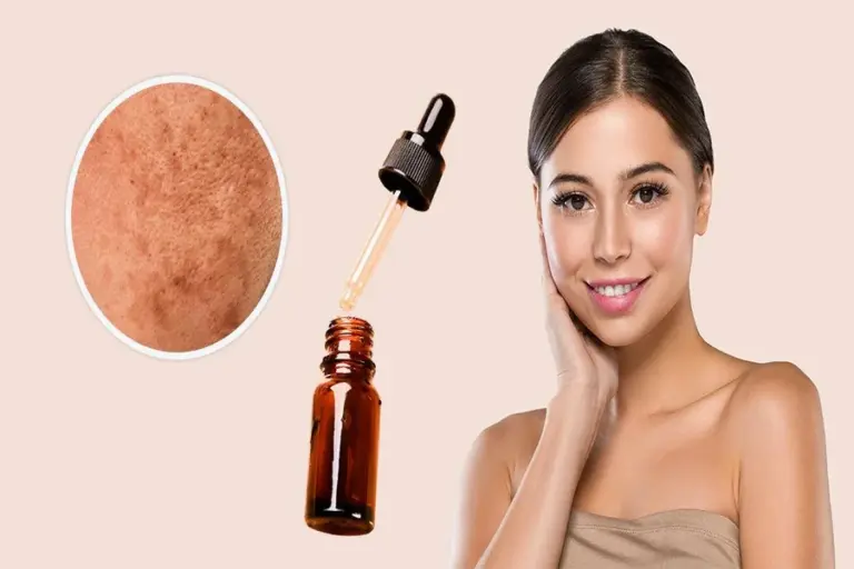 Arbutin Tranexamic Acid Face Serum Benefits Uses and Complete Skincare Guide