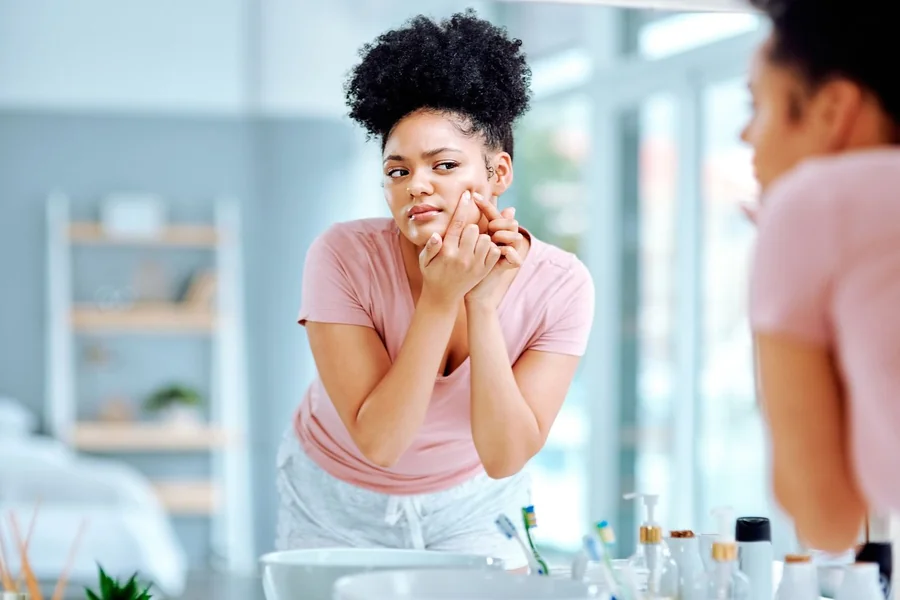 Buttock Acne Causes