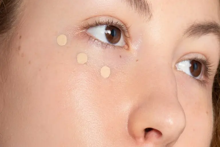 Concealers For Acne Everything You Must Know