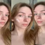 Moisturiser For Acne That Keeps Skin Healthy and Hydrated
