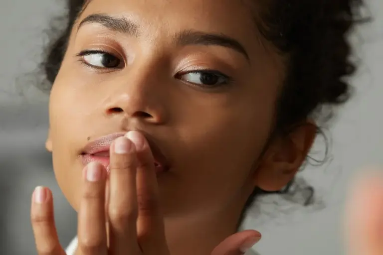 Say Goodbye To Dark Lips A Complete Guide To Tackling Lip Pigmentation Or Dark Lips and Understanding Hyperpigmentation on Lips