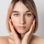 Whats And Whys Hyperpigmentation: A Complete Guide to Understanding Uneven Skin Tone